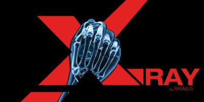 Rasmus - X-Ray - review
